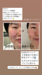 “老け見え”をリセットして、キュッと小顔に